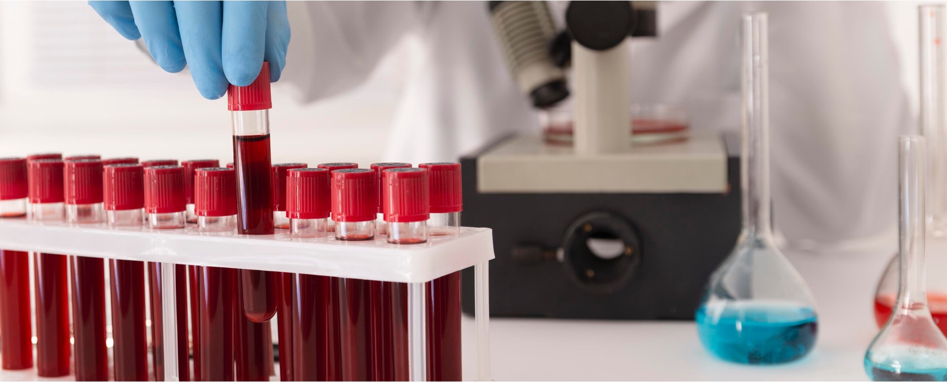 Australia elimina las restricciones que impedían donar sangre a miles de personas LGBTQ+ 